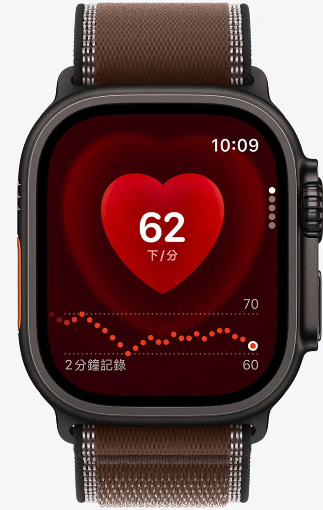 Apple Watch Series 12 擴大電極表面積以提升心電圖讀取貼合度 Apple Watch Series 12 擴大電極表面積以提升心電圖讀取貼合度